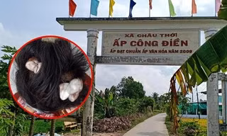 Thiếu nữ 16 tuổi ở Bạc Liêu bị người tình của mẹ đánh dập lá lách dẫn đến bất tỉnh
