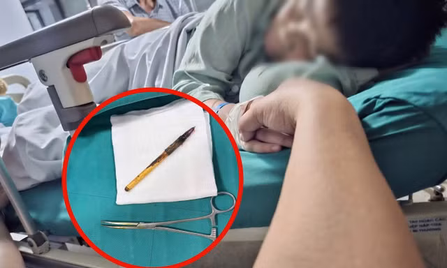 Một nam sinh lớp 6 ở Hà Nội phải mổ cấp cứu vì có dị vật, nghi bị bạo hành