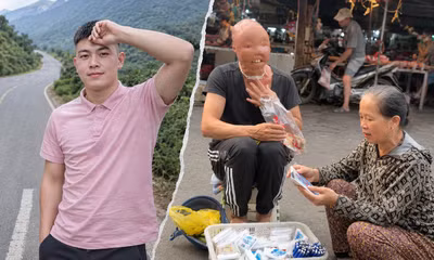 Chàng trai nghị lực mang khuôn mặt dị nhân bán hàng giữa chợ