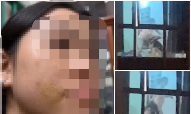 Xác minh vụ bé gái bị mẹ kế bạo hành ở Phú Thọ