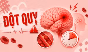TP NOW: Thiếu niên 15 tuổi bị đột quỵ, bác sỹ cảnh báo dấu hiệu không nên bỏ qua