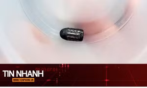 TIN NHANH: Hy hữu người phụ nữ sống sót dù bị đạn lạc găm trúng đầu
