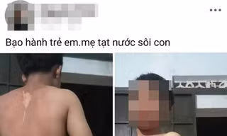 Công an vào cuộc vụ bé trai ở Đắk Lắk nghi bị mẹ tạt nước sôi