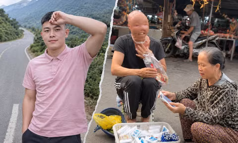Chàng trai nghị lực mang khuôn mặt dị nhân bán hàng giữa chợ