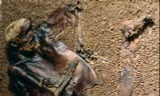 Thi thể của Lindow Man.