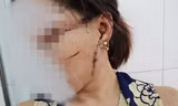 Rạch mặt, cắt gân chân vợ sau chuyến xuất khẩu lao động