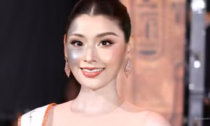 Người đẹp bị chàm nửa gương mặt giành giải á hậu