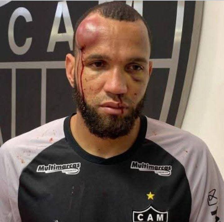 Trận đấu lập kỷ lục bạo lực nhất lịch sử Brazil với 23 thẻ đỏ 2 649302756-1566417985484653-6888186181094763110-n.jpg