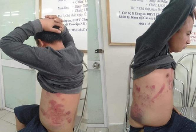 Ông Hà Văn Nam từng cho rằng, bản thân bị đánh vào ngày 28/1 vì phản đối trạm BOT thu phí sai.