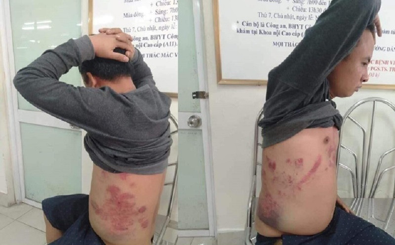 Ông Hà Văn Nam từng cho rằng, bản thân bị đánh vào ngày 28/1 vì phản đối trạm BOT thu phí sai.