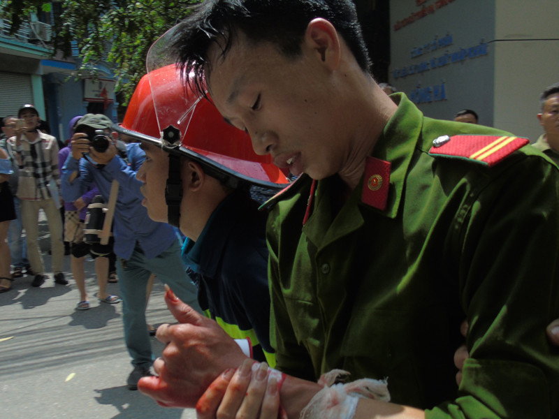 Một chiến sĩ công an bị thương khi làm nhiệm vụ. Ảnh minh họa.