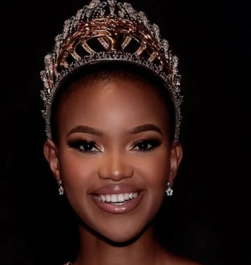 Người đẹp đầu trọc đăng quang hoa hậu