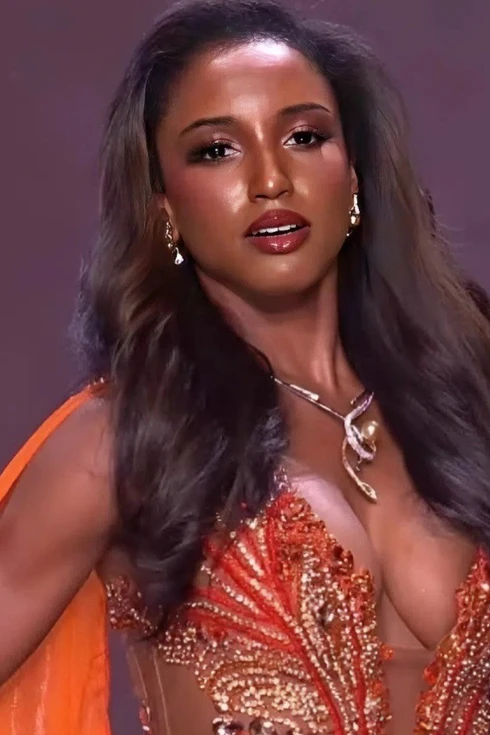 Người đẹp Jamaica bị gãy xương, xuất huyết não sau cú ngã ở Hoa hậu Hoàn vũ