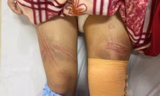 Nữ sinh lớp 7 ở Nghệ An nhập viện nghi do bị bố bạo hành