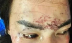 Diễn biến vụ 2 phụ nữ đánh ghen, đổ axit, xăm mặt người khác ở Cà Mau