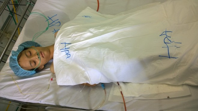 Bóc khối u 5kg cứu bệnh nhân nguy kịch