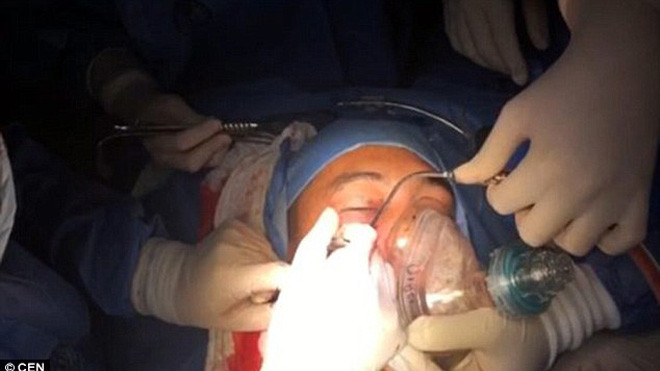 Các bác sỹ phẫu thuật lấy lựu đạn ra khỏi mặt binh sỹ