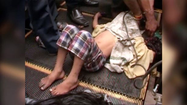 Tay cậu bé bị mắc kẹt trong thang cuốn suốt 2 tiếng