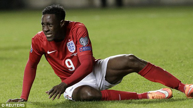 Tới lượt Welbeck dính chấn thương