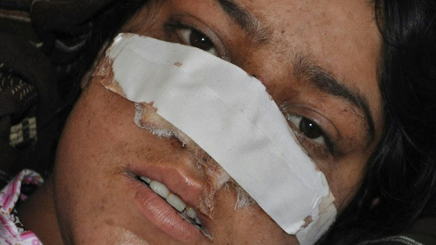 Nạn nhân Reza Gul trên giường bệnh.