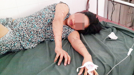 Ngoài những chấn thương trên cơ thể, chị Kết đang bị hoảng loạn tâm lý.