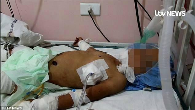 Bé gái được cấp cứu trong viện nhưng không qua khỏi