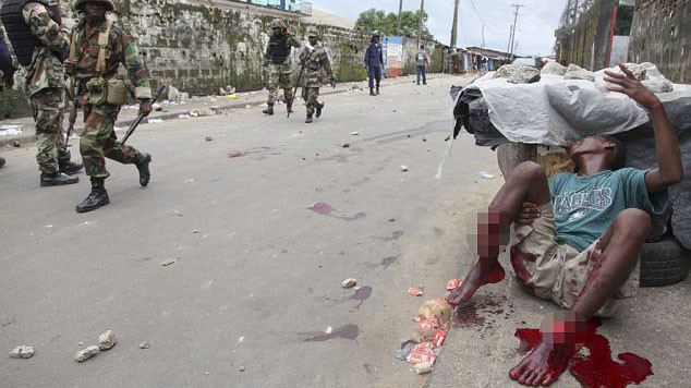 Máu chảy đầm đìa từ chân một người dân ở West Point, ngoại ô Monrovia, Liberia sau đụng độ với lực lượng an ninh