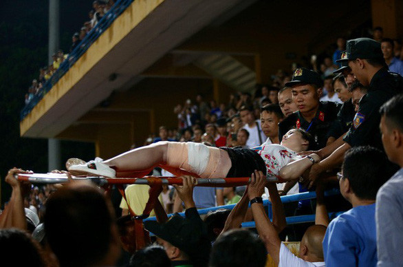 Chị Huyền Anh được chuyển tới bệnh viện điều trị sau khi trúng pháo sáng trên sân Hàng Đẫy. 