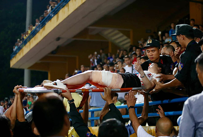 Sự cố CĐV đốt pháo sáng trên sân Hàng Đẫy khiến 1 CĐV nữ bị thương nghiêm trọng. 