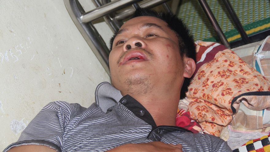 Anh Phan Châu Thức điều trị tại bệnh viện.