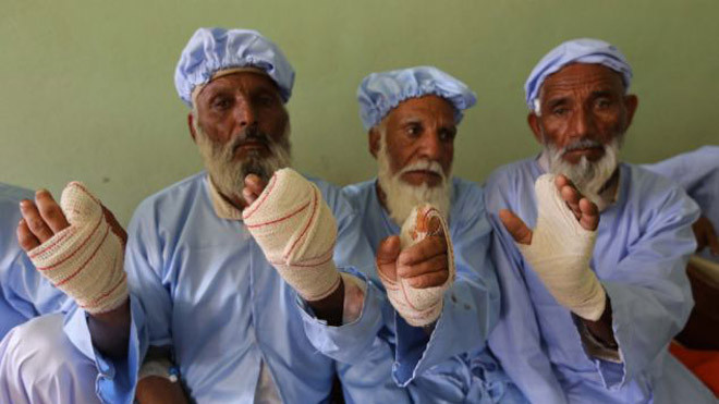 Những cử tri bị chặt đứt ngón tay trỏ vì đi bỏ phiếu