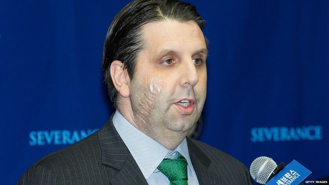 Đại sứ Mỹ tại Hàn Quốc Mark Lippert