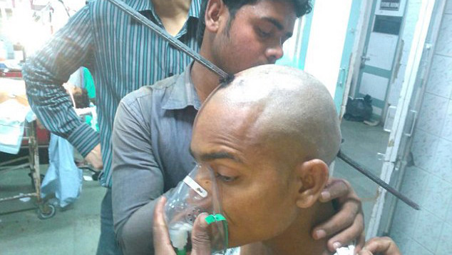 Anh Mohammad Guddu bị thanh sắt đâm xuyên đầu
