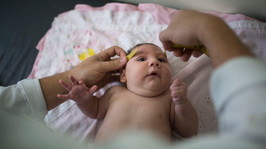 Virus zika gây dị tật đầu nhỏ bẩm sinh đang hoành hành ở châu Mỹ Latinh