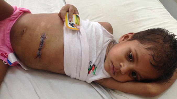  Sivam Kumar sau ca phẫu thuật 