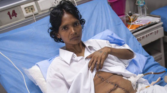 Cô Nunwati Devi sau ca phẫu thuật. Ảnh: Metro