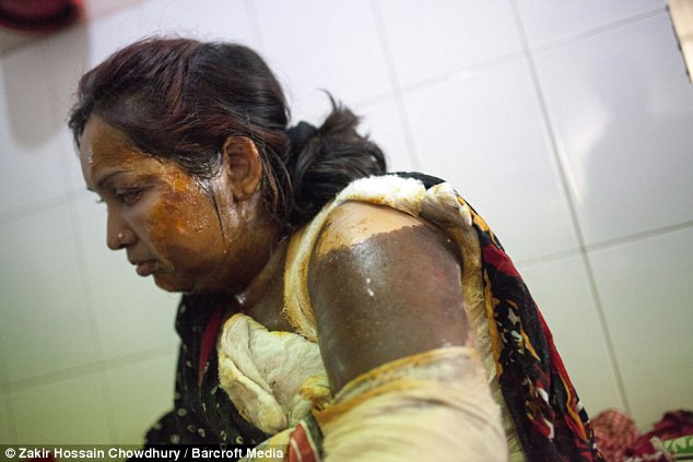 Tania Parvin trong bệnh viện. Ảnh: Dailymail