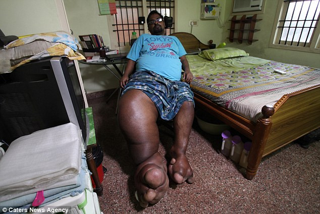 Anh Arun Rajasingh. Ảnh: Dailymail