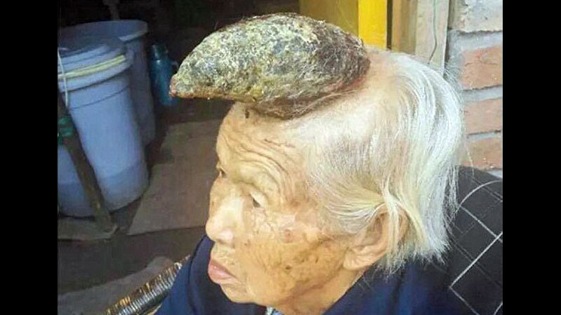 Chiếc sừng to trên đầu cụ Liang Xiuzhen