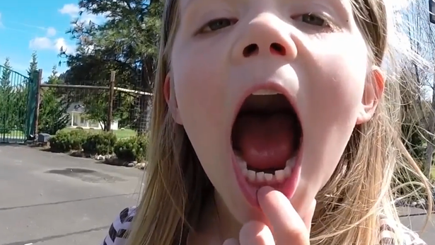 Bé Ariana khoe chiếc răng đang lung lay