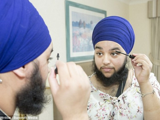 Cô gái muốn tự tử vì... mọc râu quai nón