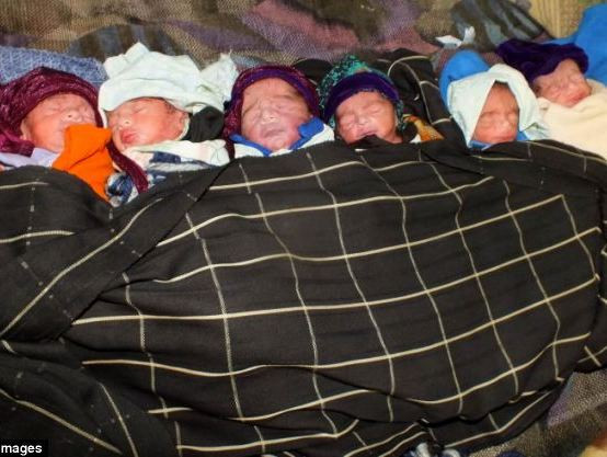 Ca sinh 6 kì diệu ở Pakistan