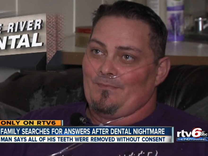 Anh Donny Grigby hiện không còn chiếc răng nào.