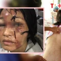 HÌNH SỰ: Hai mẹ con bị gã 'chồng hờ' đánh đập dã man