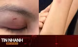 TIN NHANH: Luật sư nhận định vụ ca sĩ Trung Quân Idol bị tố đánh phụ nữ