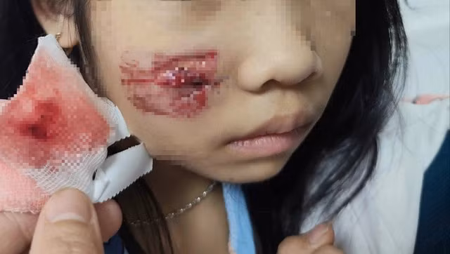 Cháu bé bị khỉ hoang tấn công khi chơi ở sân nhà