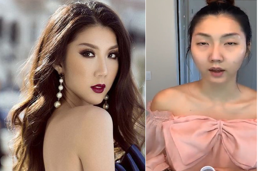 'Hốt hoảng' trước gương mặt khác lạ khó tin của siêu mẫu Ngọc Quyên, thực hư ra sao? 