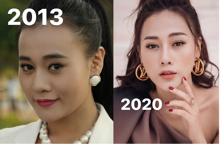 Phương Oanh chia sẻ quá trình 'lột xác' với nhan sắc hiện tại sau phẫu thuật thẩm mỹ