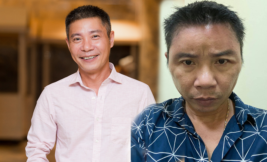 'Hốt hoảng' trước gương mặt sưng vù của NSND Công Lý 