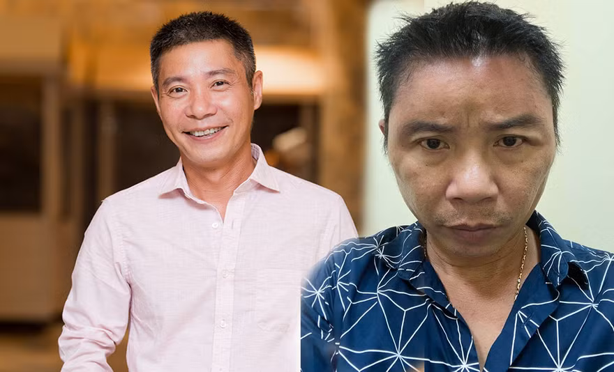 'Hốt hoảng' trước gương mặt sưng vù của NSND Công Lý 